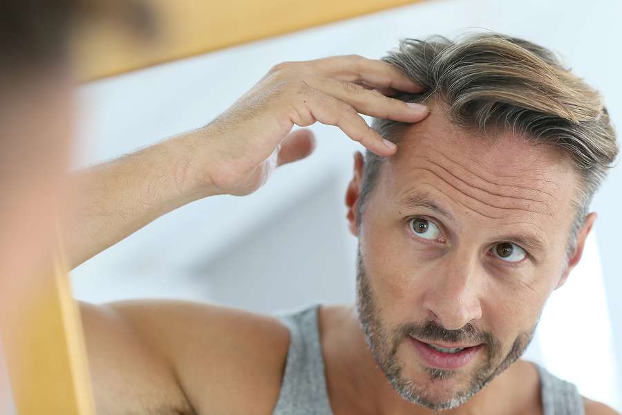 hair loss spray products